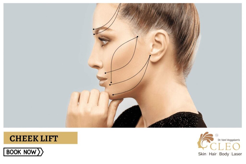 Say Goodbye to Sagging Cheeks with Cheek Lift at Cleo Skin Clinic, Hyderabad