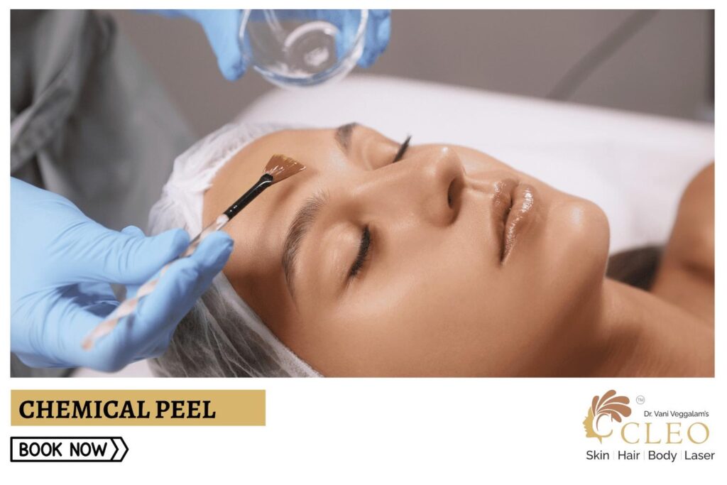 Revitalize Your Skin with Chemical Peel at Cleo Skin Clinic, Hyderabad