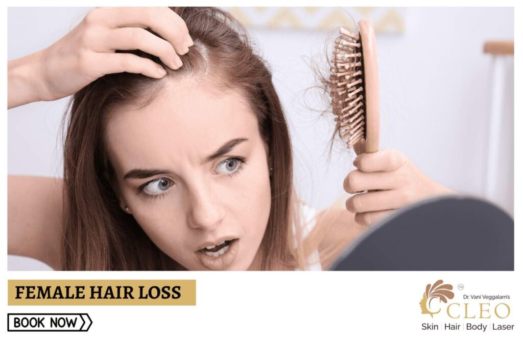 Female Hair Loss: Comprehensive Care at Cleo Skin Clinic, Hyderabad