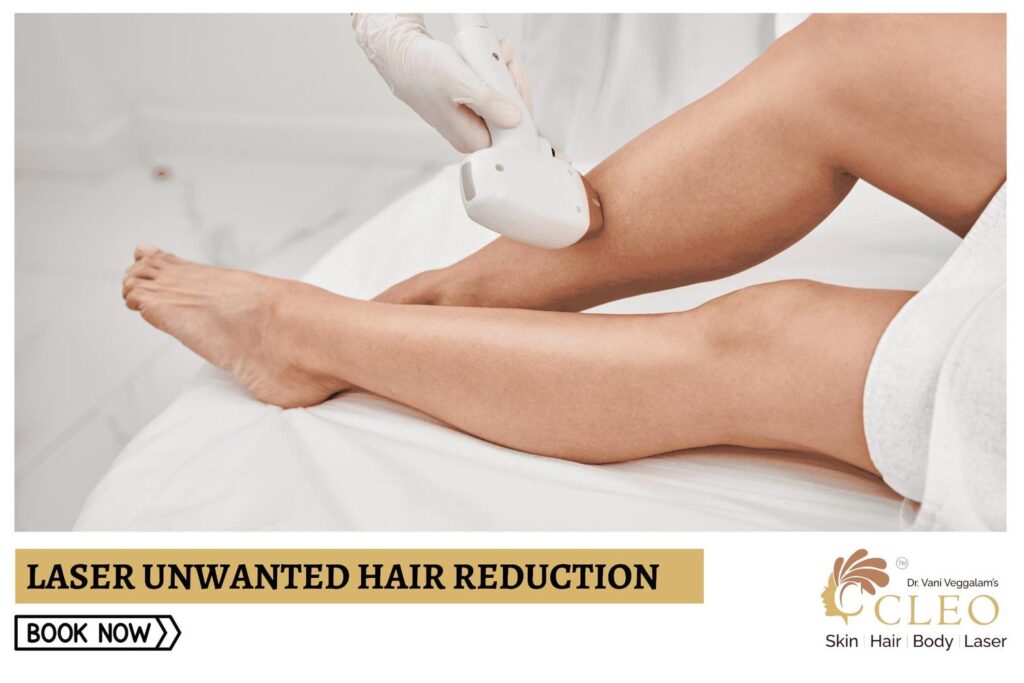 Say Goodbye to Unwanted Hair with Laser Hair Reduction at Cleo Skin Clinic, Hyderabad