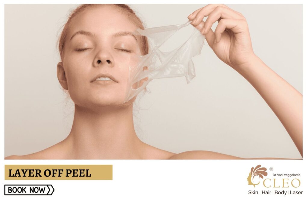 Renew Your Skin with Layer Off Peel at Cleo Skin Clinic, Hyderabad