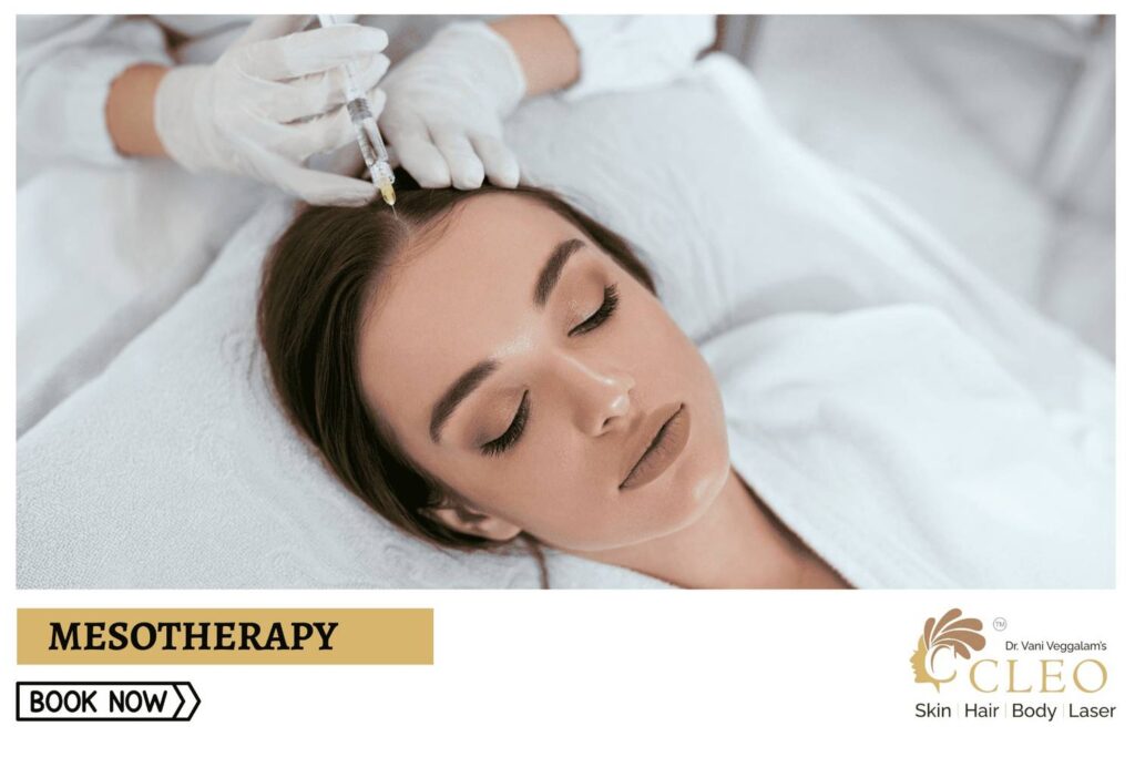 Mesotherapy Face Treatment at Cleo Skin Clinic, Hyderabad