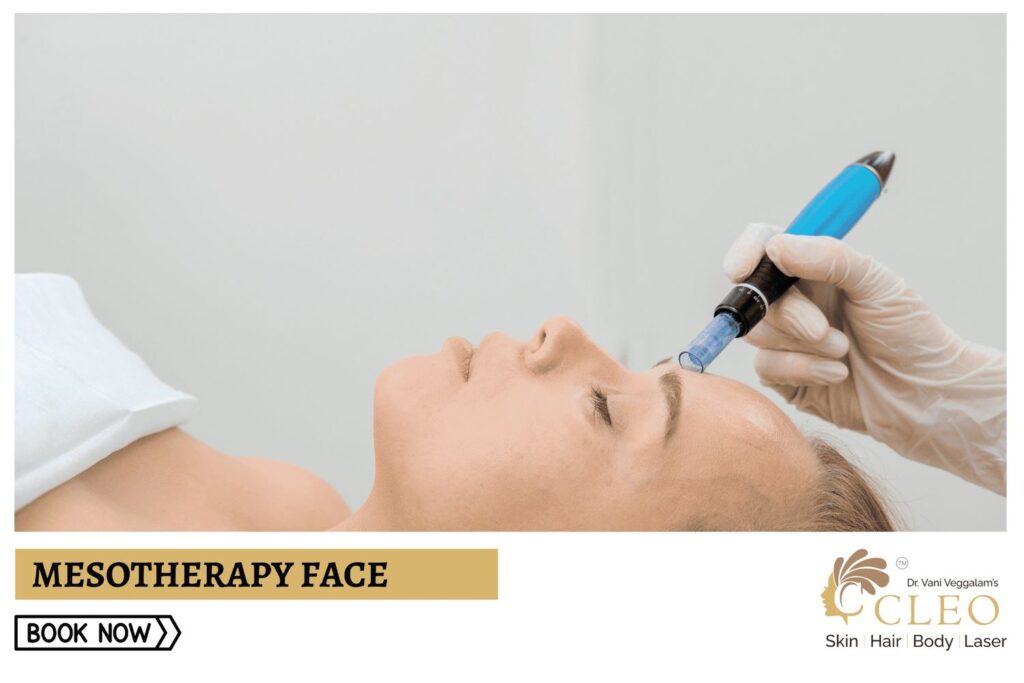 Mesotherapy Face Treatment at Cleo Skin Clinic, Hyderabad