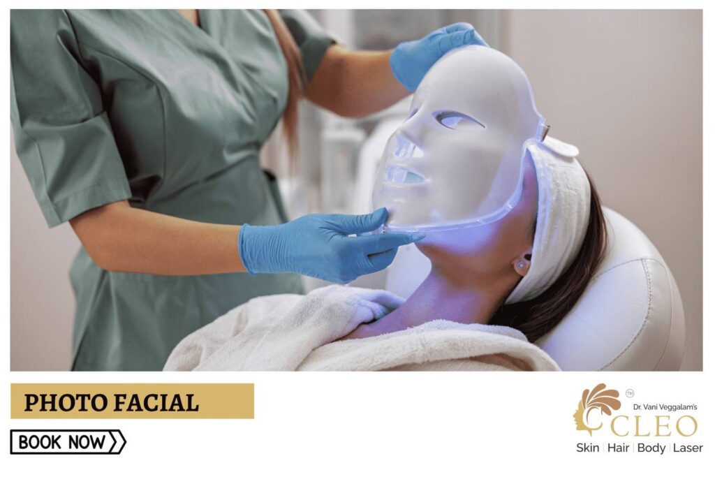 Illuminate Your Skin with PhotoFacial at Cleo Skin Clinic, Hyderabad