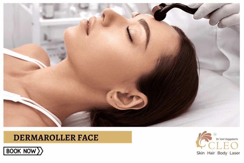 Rejuvenate Your Skin with Dermaroller Face Treatment at Cleo Skin Clinic, Hyderabad