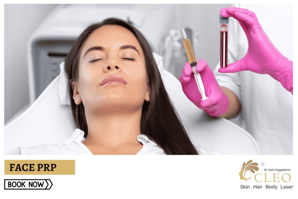 Achieve a Youthful Glow with Face PRP at Cleo Skin Clinic, Hyderabad