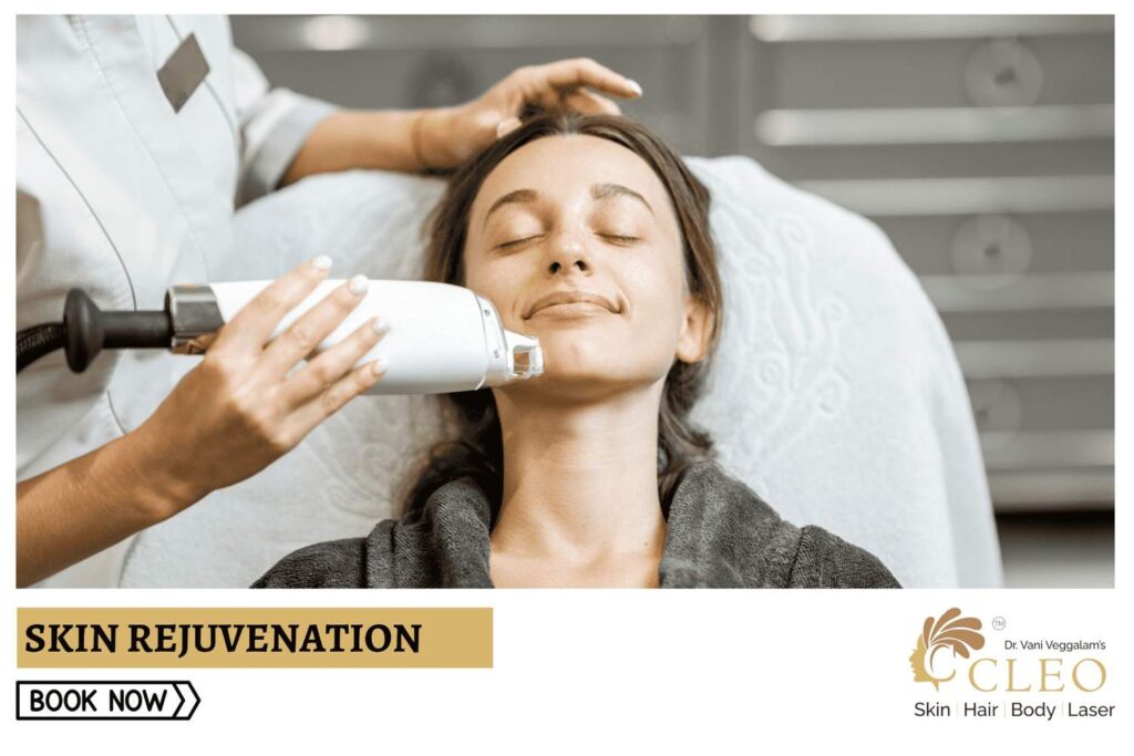 Rejuvenate Your Skin with Skin Rejuvenation to Eliminate Wrinkles at Cleo Skin Clinic, Hyderabad